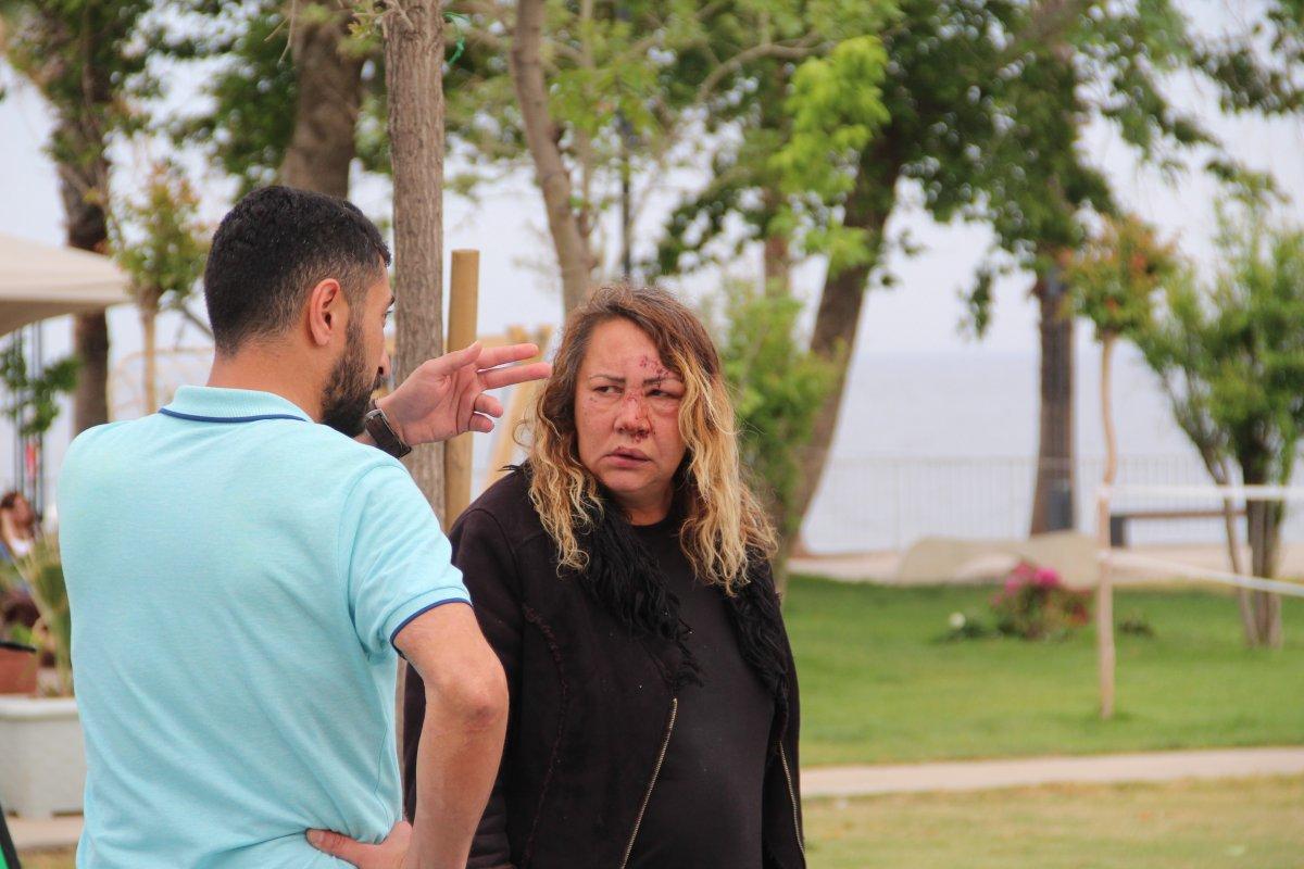 Antalya'daki Rus kadın darbedildi