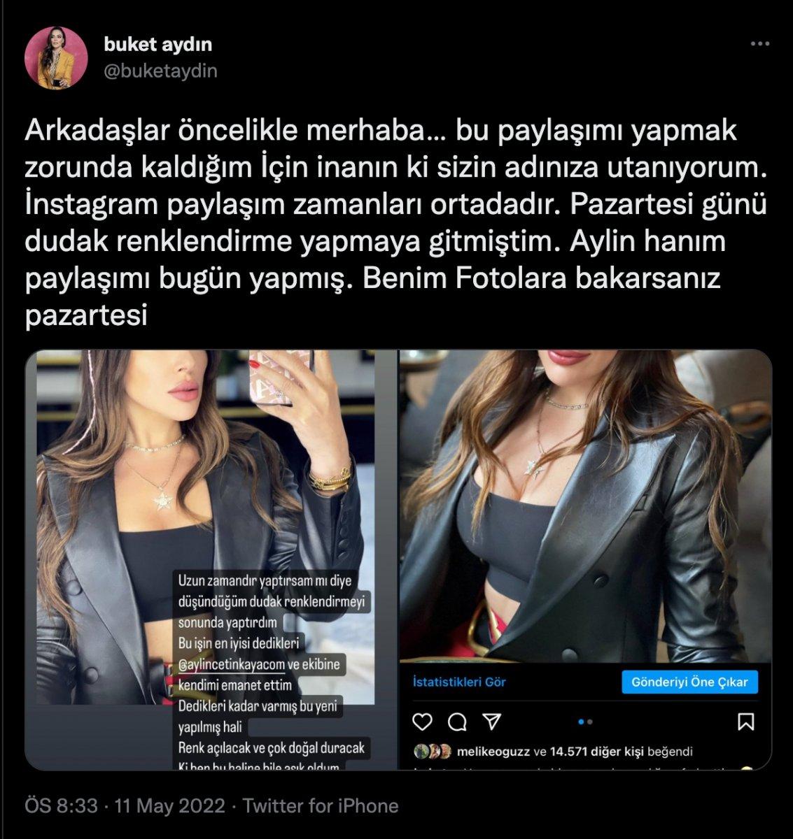 Buket Aydın 'estetikçiye gitti' iddiasına sert çıktı