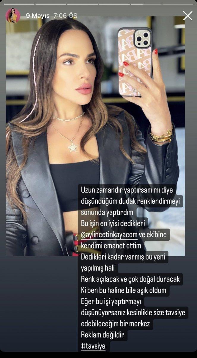 Buket Aydın 'estetikçiye gitti' iddiasına sert çıktı