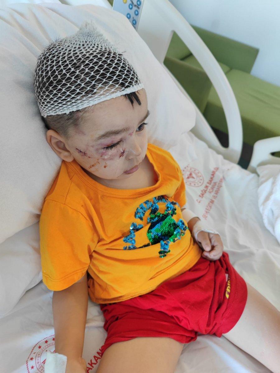 Adana'da güzellik yarışmasına katılan köpek, küçük çocuğun yüzünü parçaladı