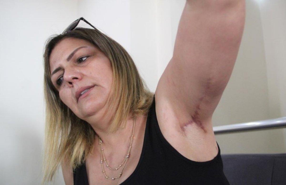 Antalya'da bir kadın estetik mağduru oldu