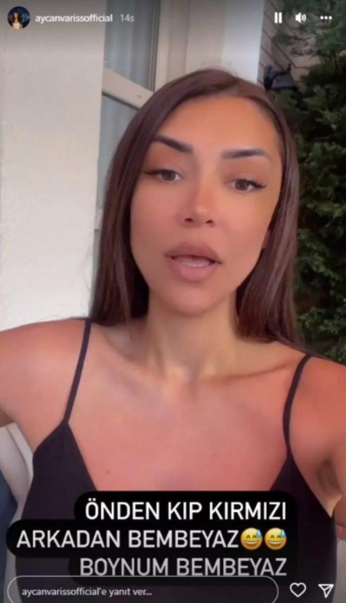 Kısmetse Olur Aycan Varış: Piliç gibi yandım