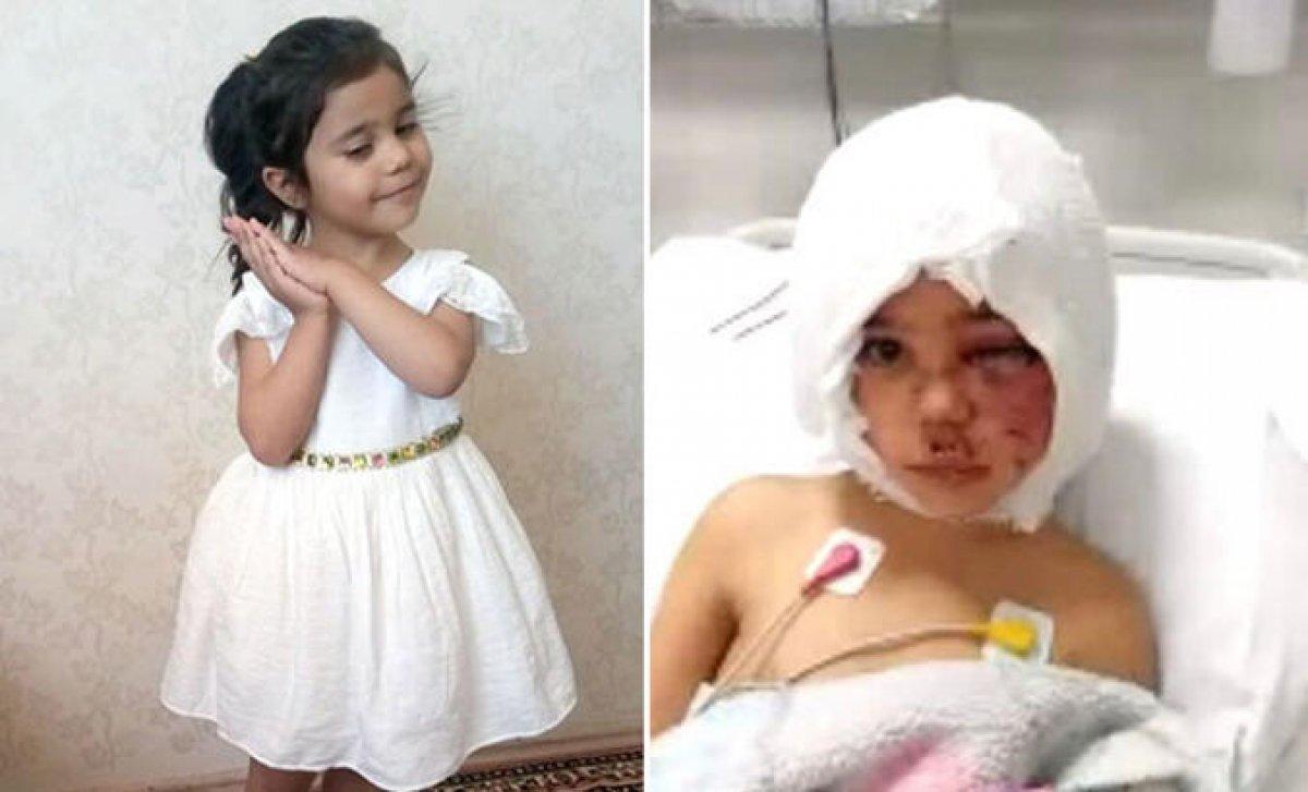 Asiye'ye pitbull saldırısı davasında tutuklu sanık kalmadı