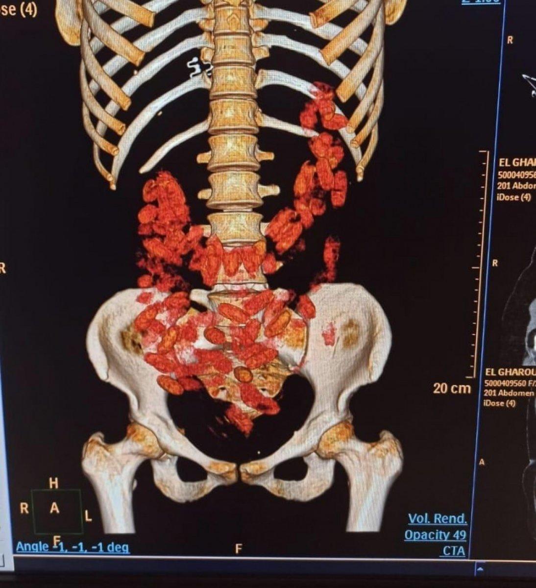 Urfi Çetinkaya'nın kardeşi Aydın Çetinkaya gözaltına alındı