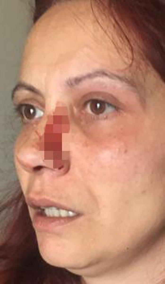 Büyükçekmece’deki kadın oturduğu sitede darbedildi