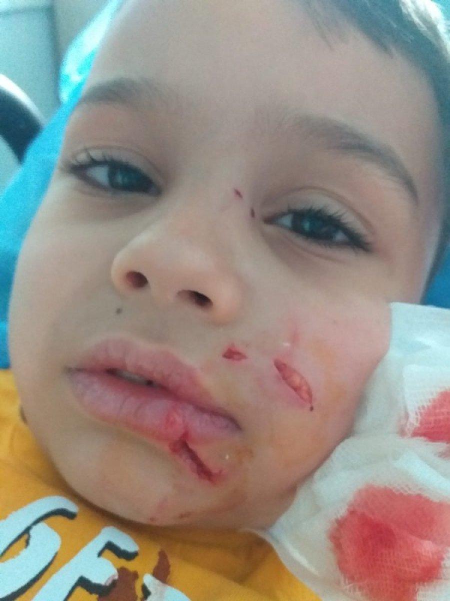 Niğde'de, annesiyle parka giden çocuğa köpek saldırdı