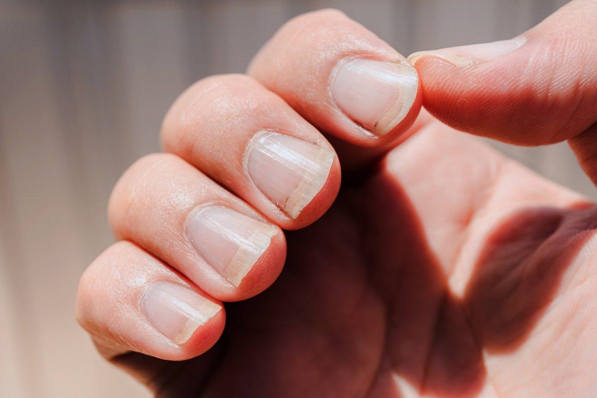 Zayıf tırnakları güçlendirmek için 15 etkili yöntem