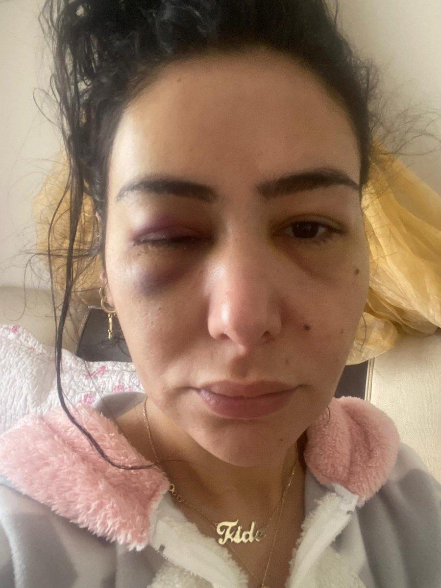 Adana'da 'merhabalaştığı' kadına işkence eden şahsın görüntüleri