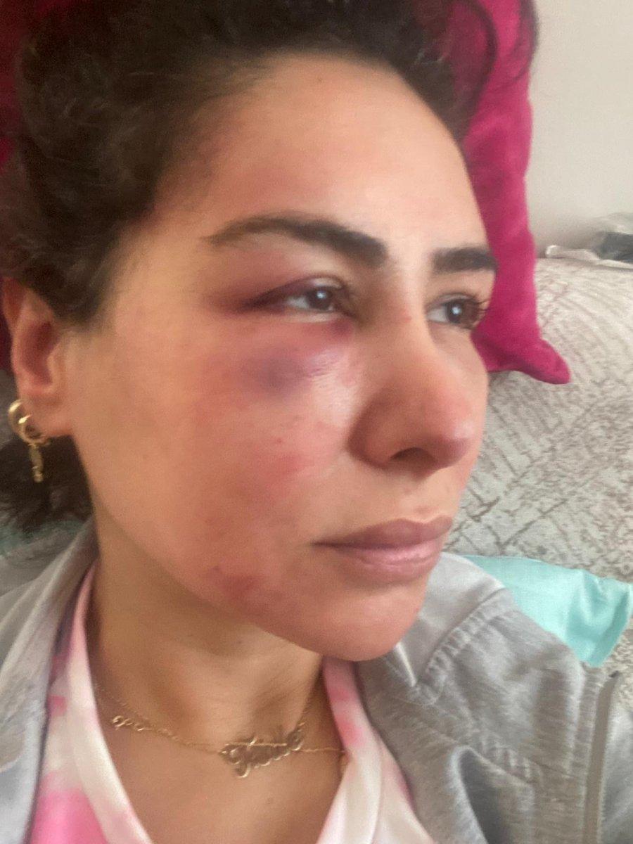 Adana'da 'merhabalaştığı' kadına işkence eden şahsın görüntüleri