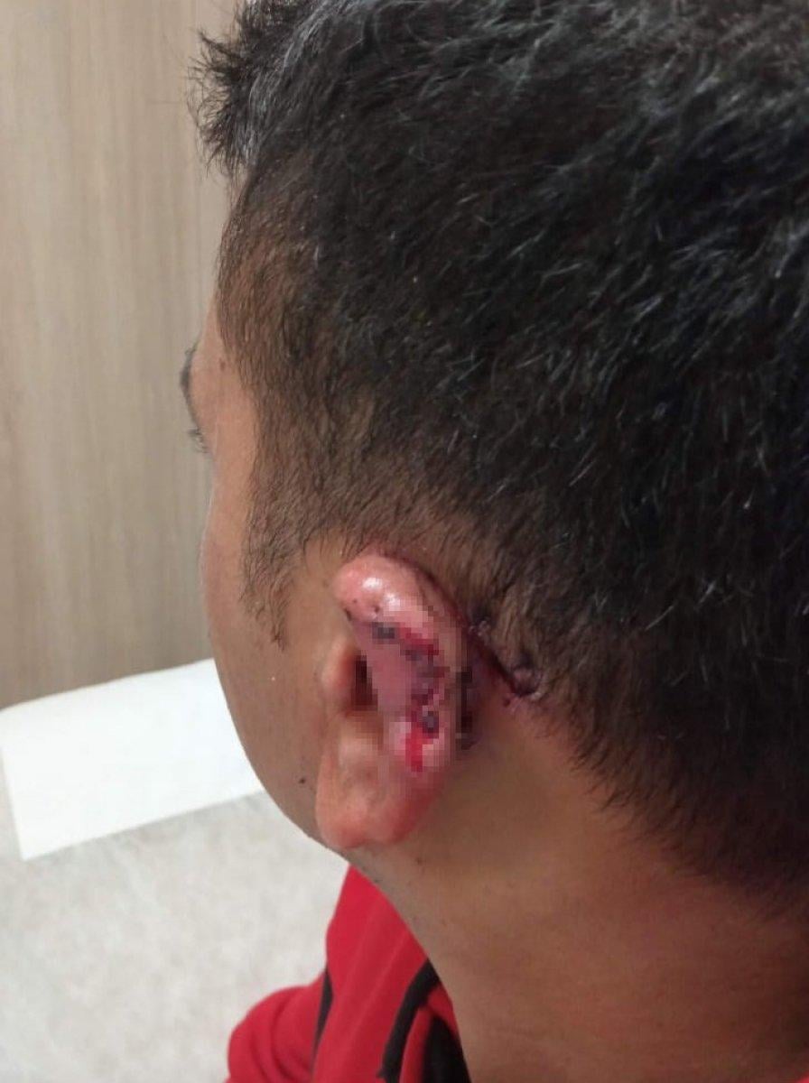 İstanbul'da kavgada kopan kulağı martı alıp götürdü