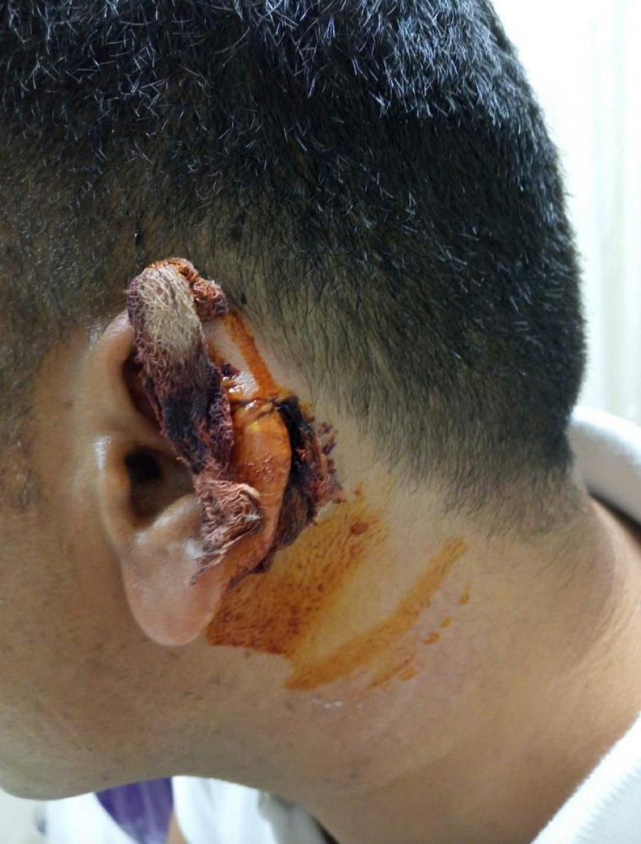 İstanbul'da kavgada kopan kulağı martı alıp götürdü