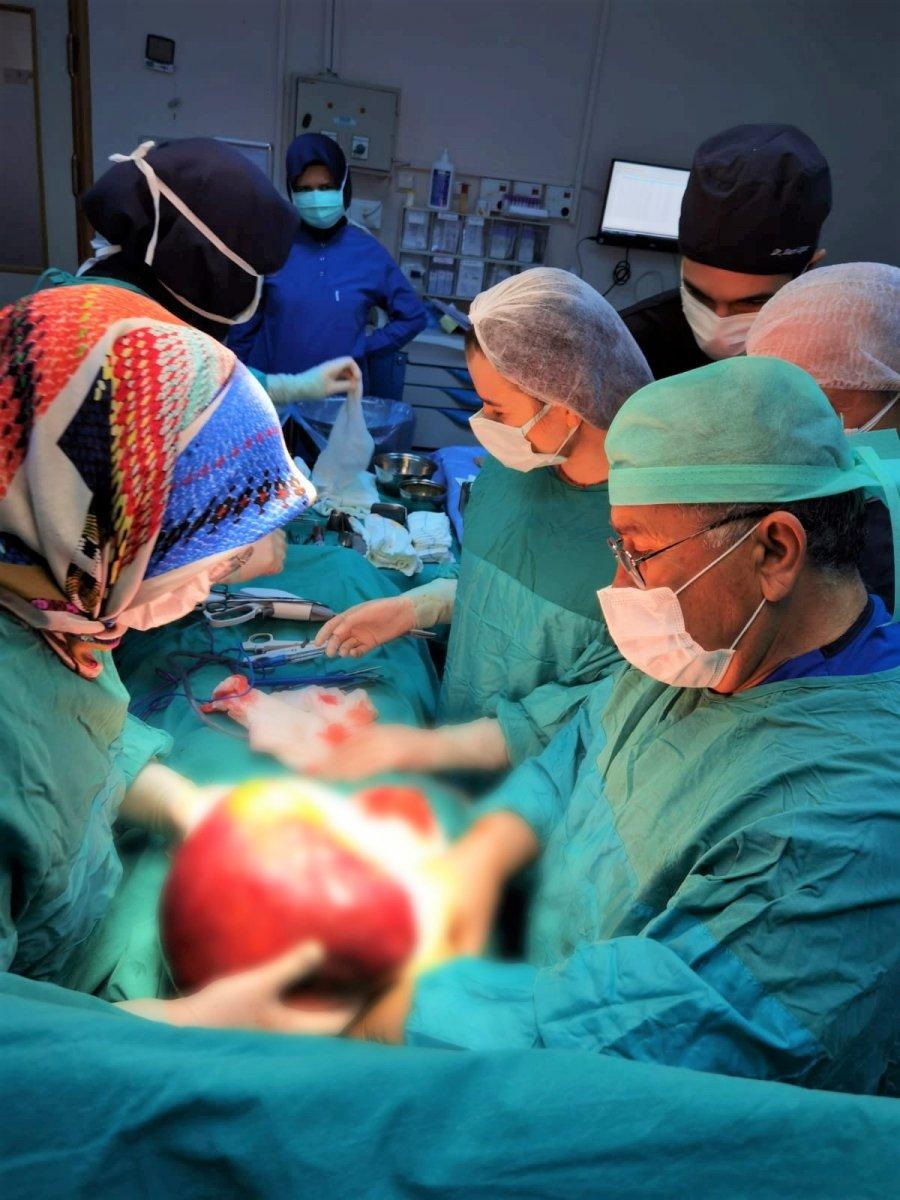 Amasya'daki genç kızın karnından çıkan kitle şaşırttı