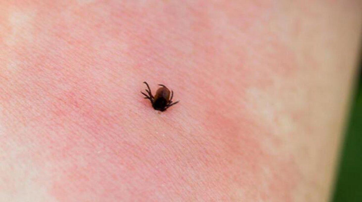 Sivas'ta KKKA yüzünden ölenlerin sayısı 3'e çıktı