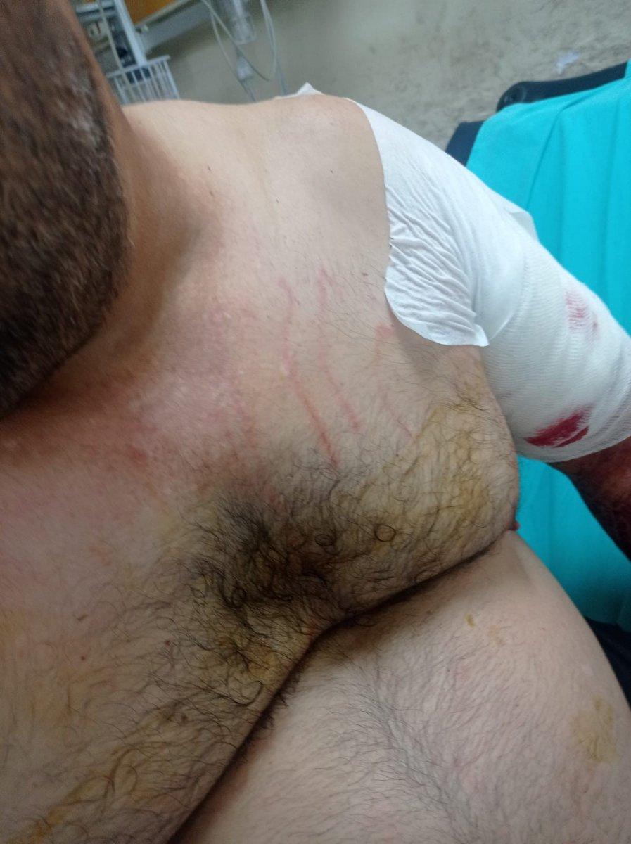 Bartın’da ayı saldırısı: Yerden yere vurdu