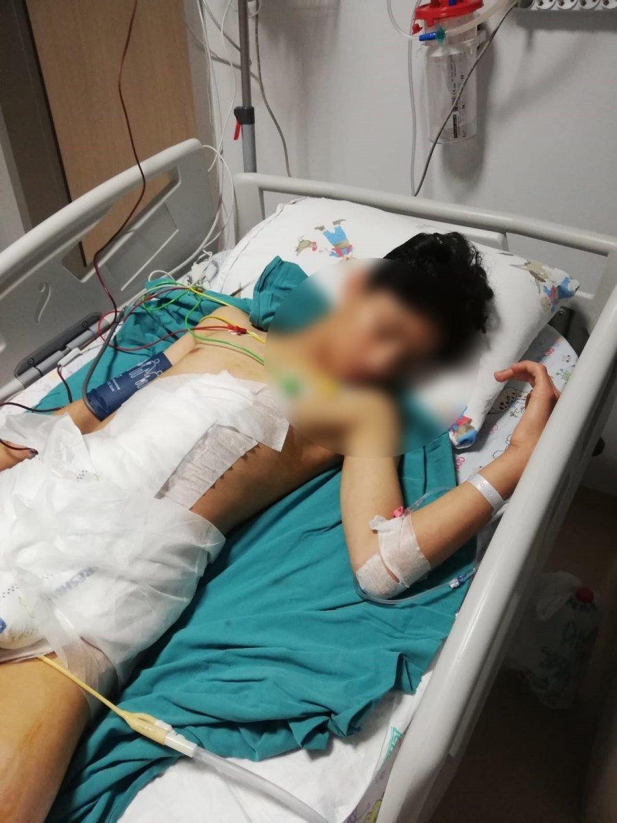 Çorum'da köpeklerden kaçarken yaralanan çocuk iyileşti