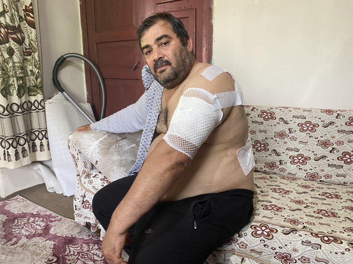 Bartın'daki vatandaşa ayı saldırdı