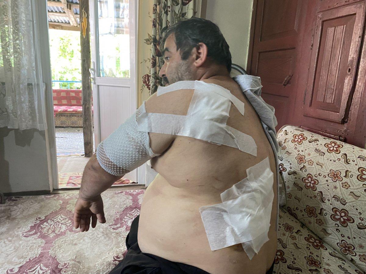 Bartın'daki vatandaşa ayı saldırdı