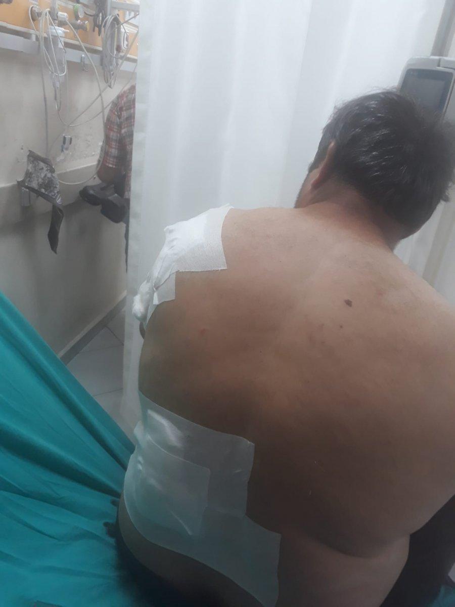 Bartın'daki vatandaşa ayı saldırdı