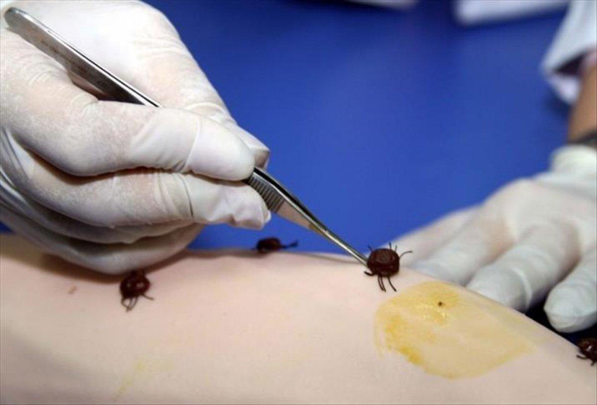 Sivas'ta KKKA tedavisi gören 2 kişi kurtarılamadı