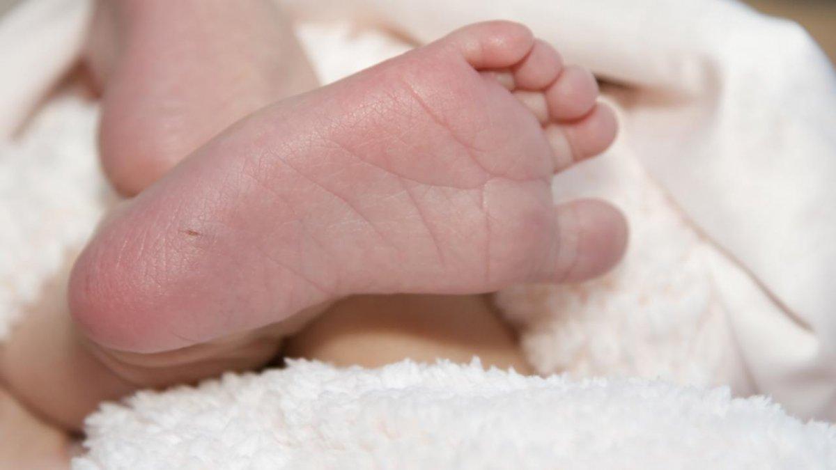 Çocuklarda zeka geriliğine neden olan hastalık: Fenilketonüri