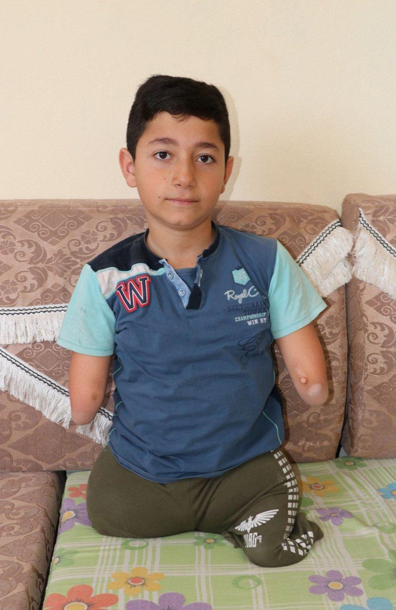 Van'da kolları ve bacakları olmayan çocuk, protez için destek bekliyor