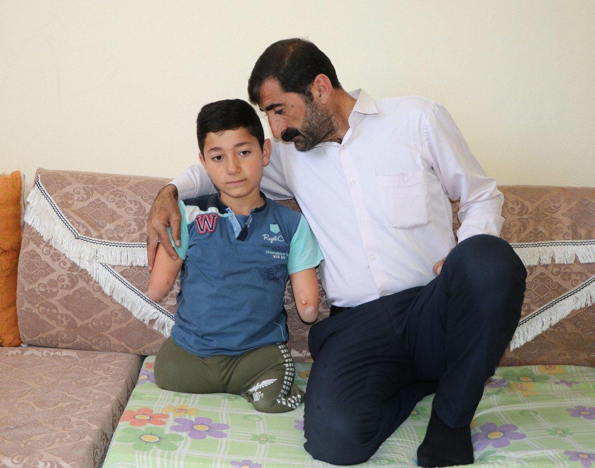 Van'da kolları ve bacakları olmayan çocuk, protez için destek bekliyor