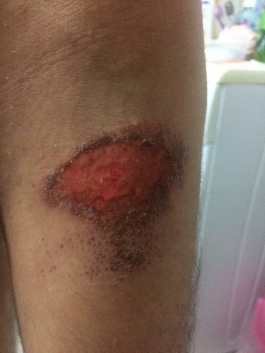 İzmir'de, otizmli çocuğun yatağa bağlanmasına  inceleme