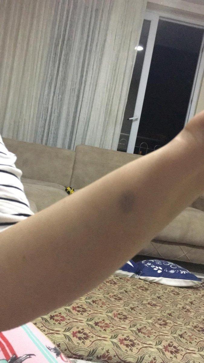 Antalya'da komşusunun kavgasını ayırmak isteyen adımın başına gelmeyen kalmadı