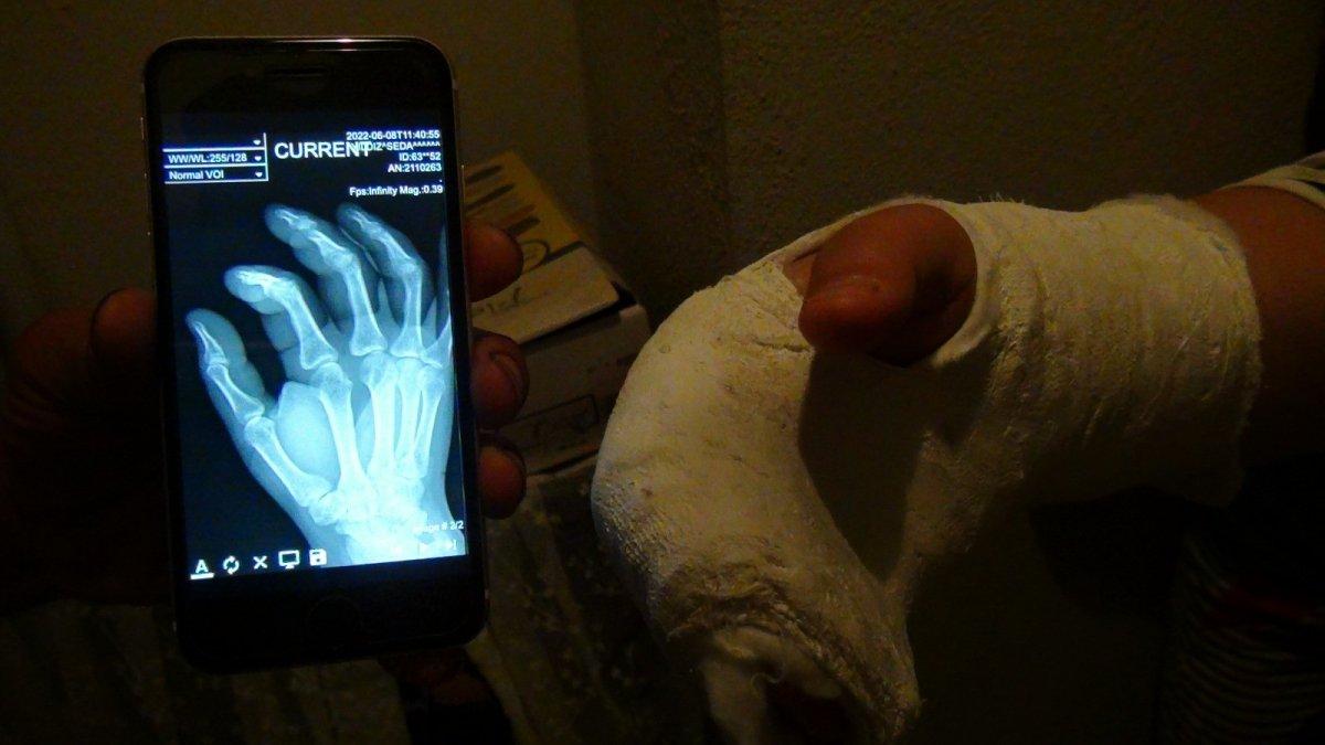 Antalya'da komşusunun kavgasını ayırmak isteyen adımın başına gelmeyen kalmadı