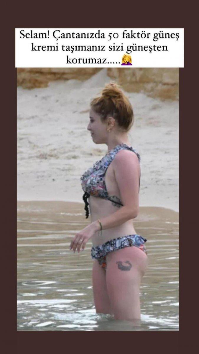 Hazal Kaya güneş kremi mağduru