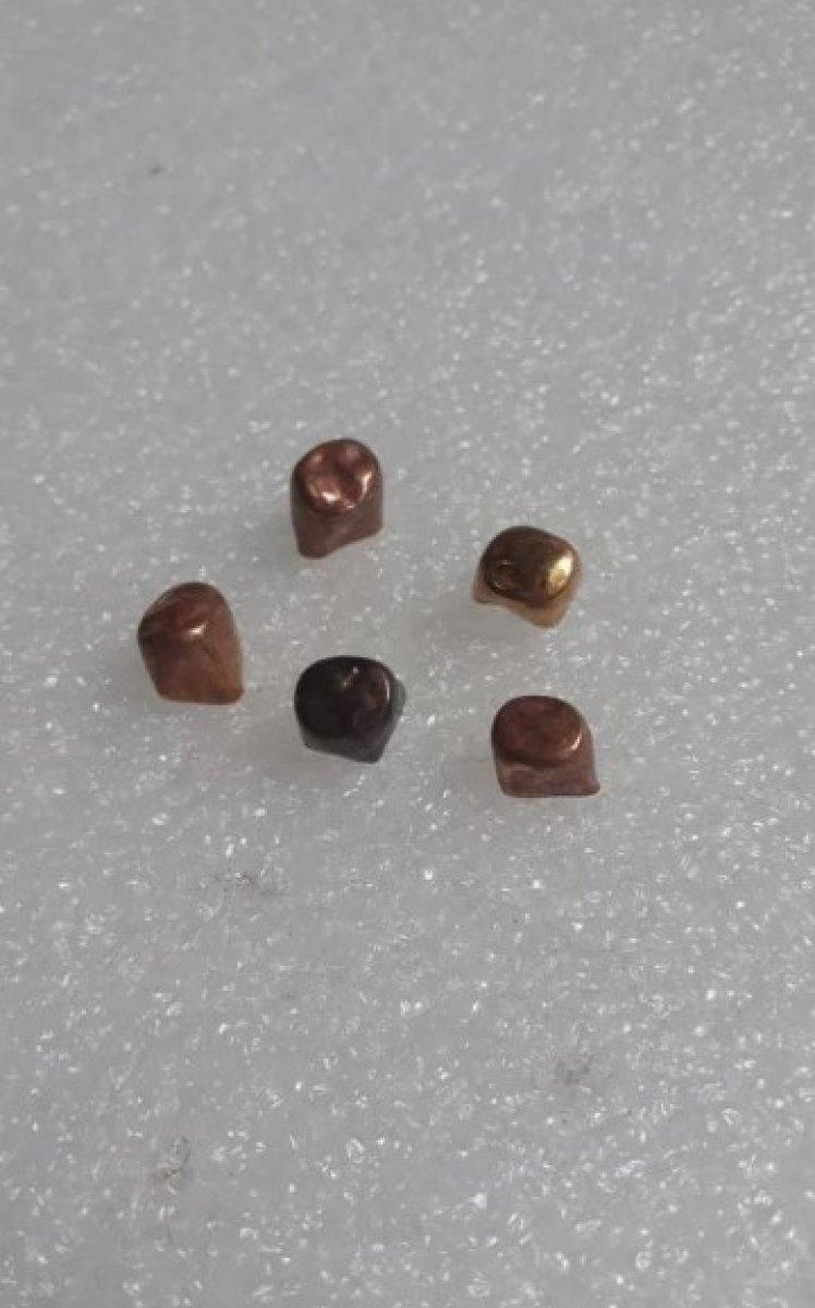 Zonguldak'ta bir kişi sahte altın dişlerle kuyumcuyu dolandırdı