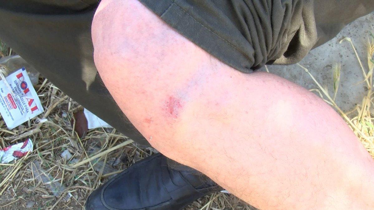 Beylikdüzü'nde eski nişanlı dehşeti: Taksinin önünü kesip saldırdı