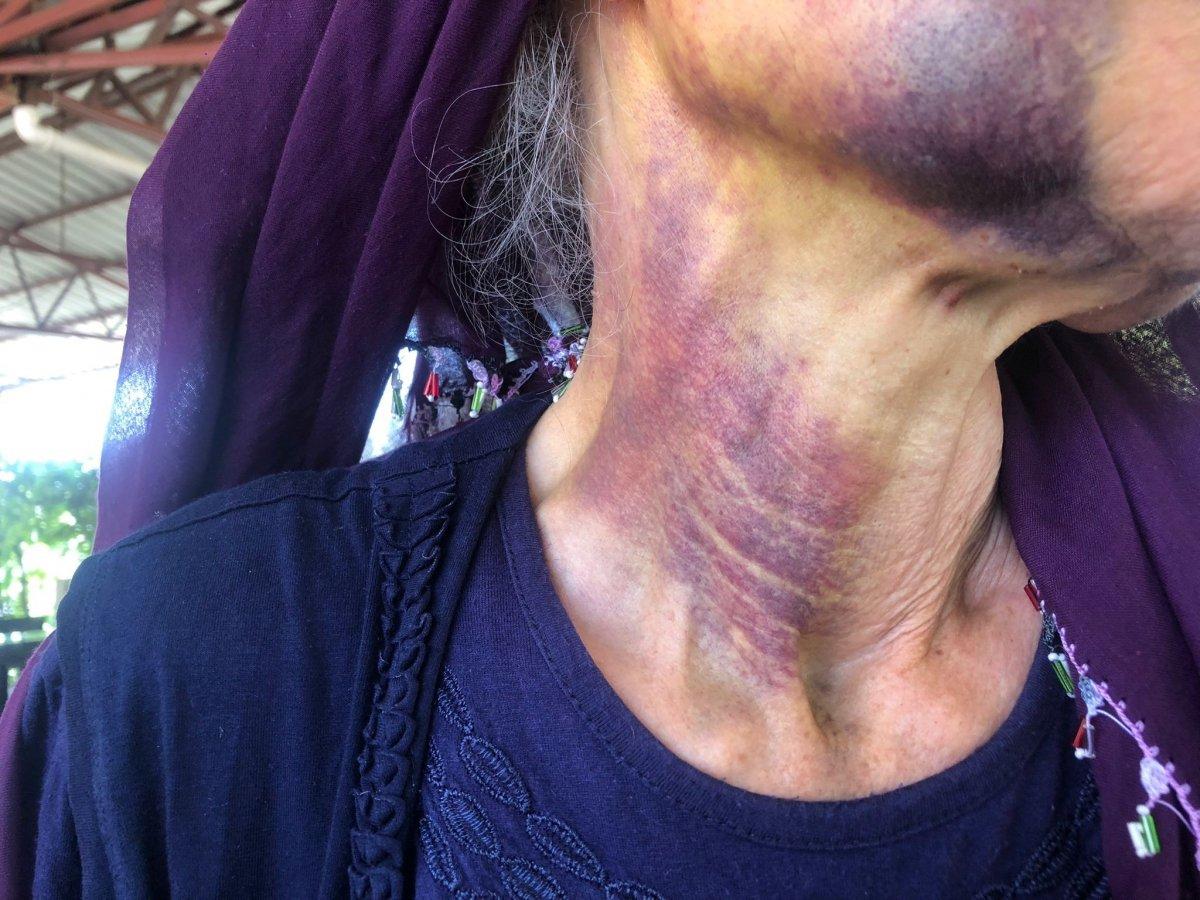 Adana'da kuzusu akrabasının sürüsüne karışınca darbedildi