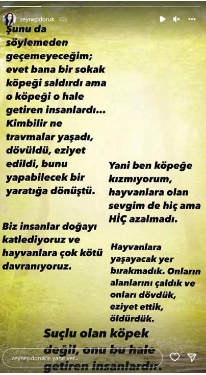 Şarkıcı Zeynep Doruk’a sokak köpeği saldırdı