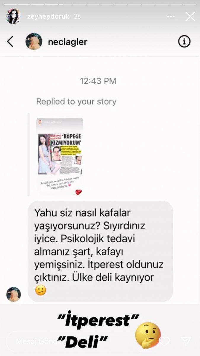 Şarkıcı Zeynep Doruk’a sokak köpeği saldırdı