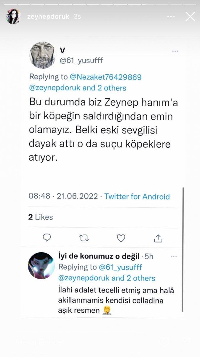 Şarkıcı Zeynep Doruk’a sokak köpeği saldırdı