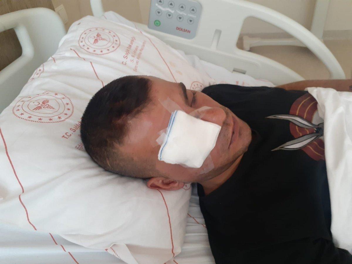 Antalya'da yüzde 40 engelli adamı öldüresiye dövüp gözünden ettiler