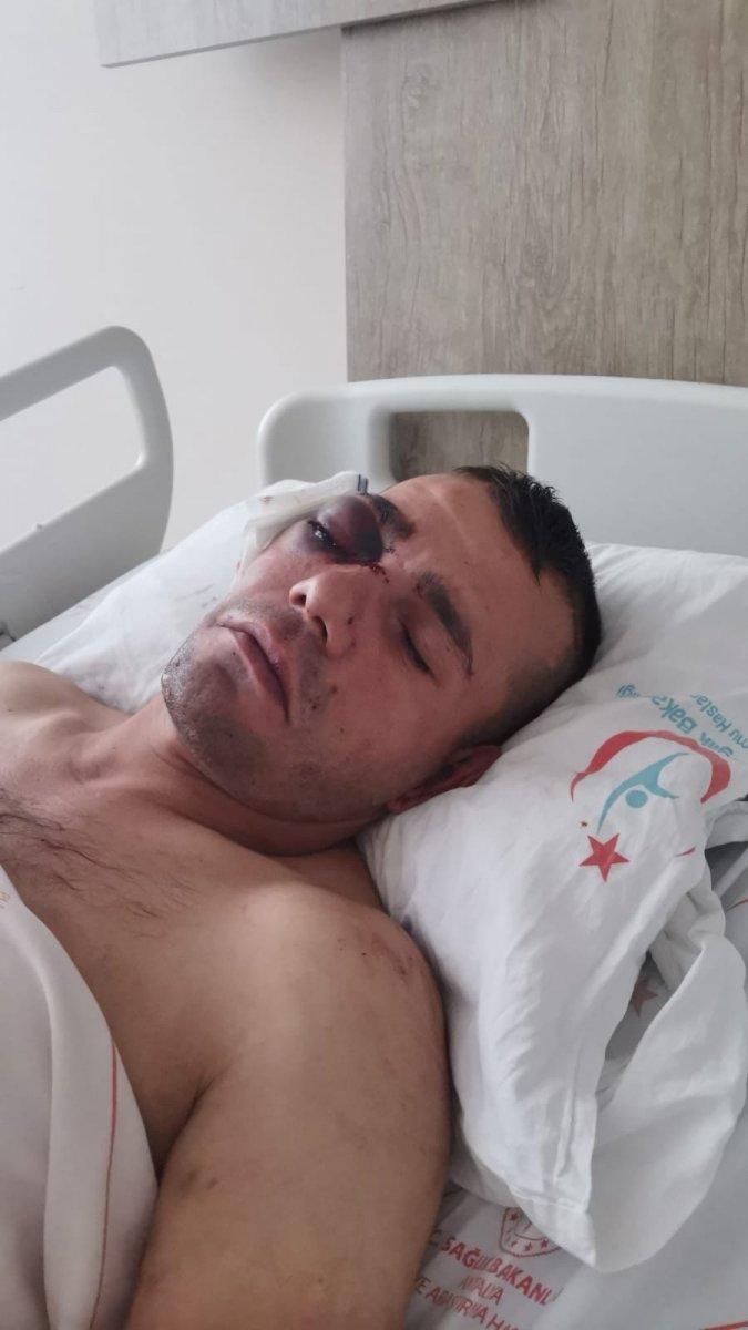 Antalya'da yüzde 40 engelli adamı öldüresiye dövüp gözünden ettiler