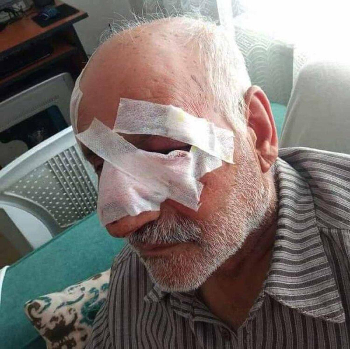 Gaziantep'te köpek saldırısına uğrayan yaşlı adam yoğun bakımda