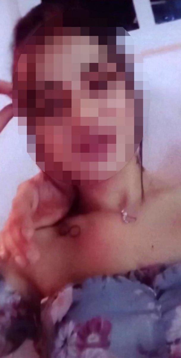 Denizli'de altın dişli dolandırıcı, gazinoda eğlenirken yakalandı