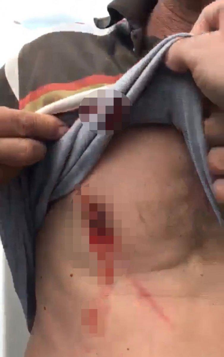 Sakarya’da trafikte tartıştığı 3 kişiyi falçatayla yaraladı