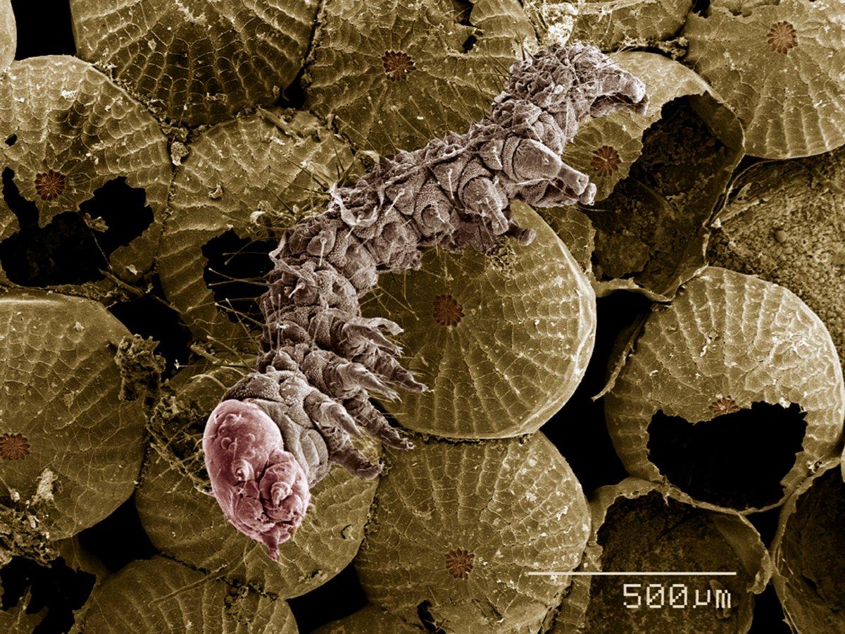 İnsan vücudu için en tehlikeli 7 parazit