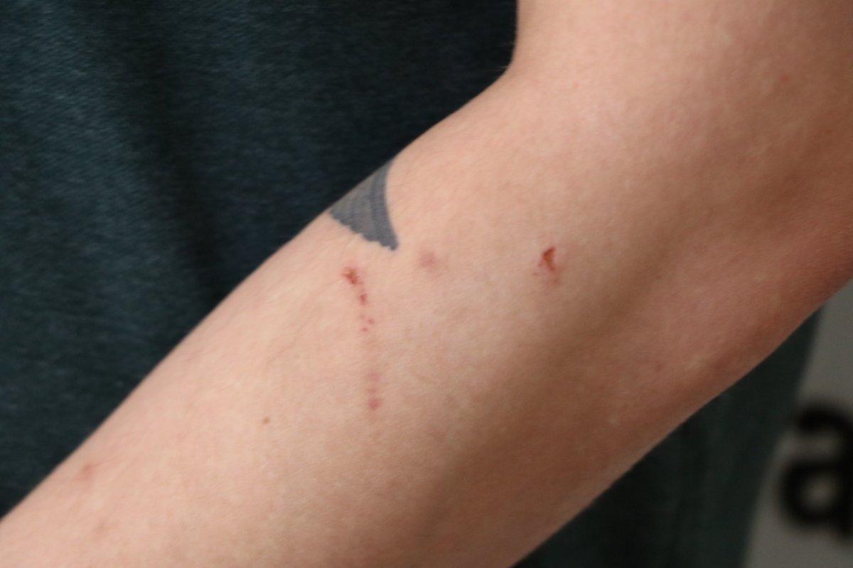 Şanlıurfa’da hasta yakınlarının darbettiği doktor konuştu