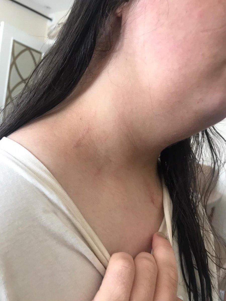 Adana’daki bir düğünde ‘saça dokunma’ kavgası