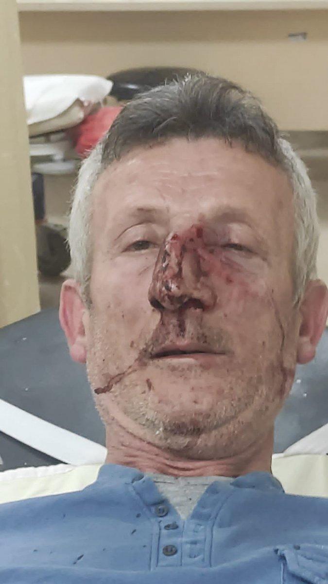 Bursa'da, site yönetimi zamma karşı çıkan engelli adamı darbetti