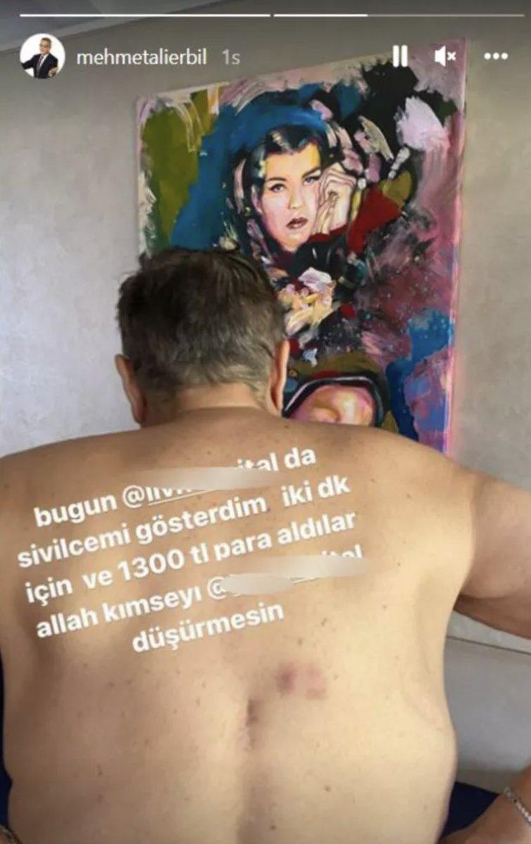 Mehmet Ali Erbil özel hastane ücretine isyan etti