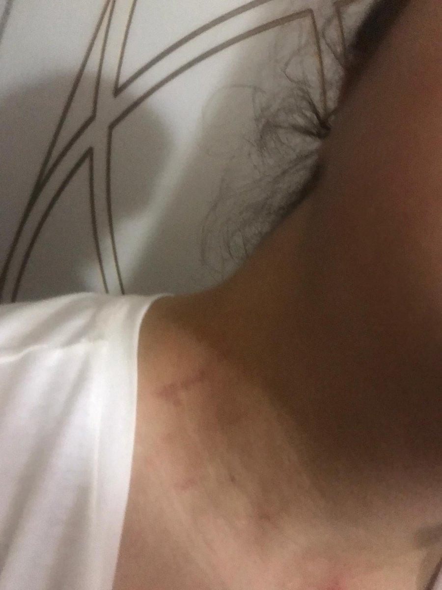 Adana’daki bir düğünde ‘saça dokunma’ kavgası