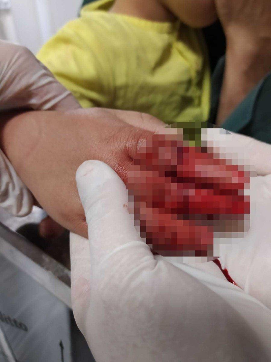 Nevşehir'de 4 yaşındaki çocuk elini kıyma makinesine kaptırdı