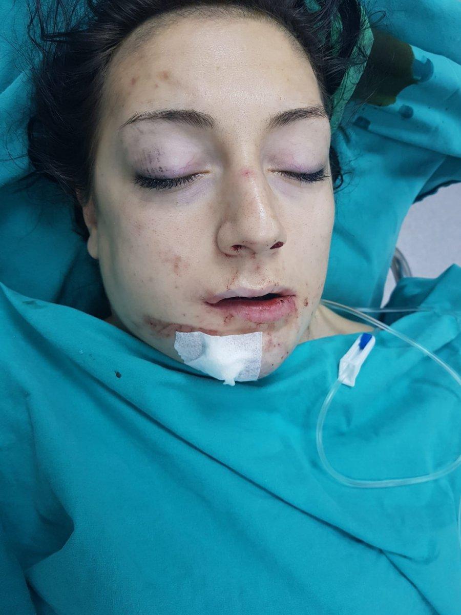 Üzerine halter düştü, 2,5 ay sonra mucizevi sporcu oldu