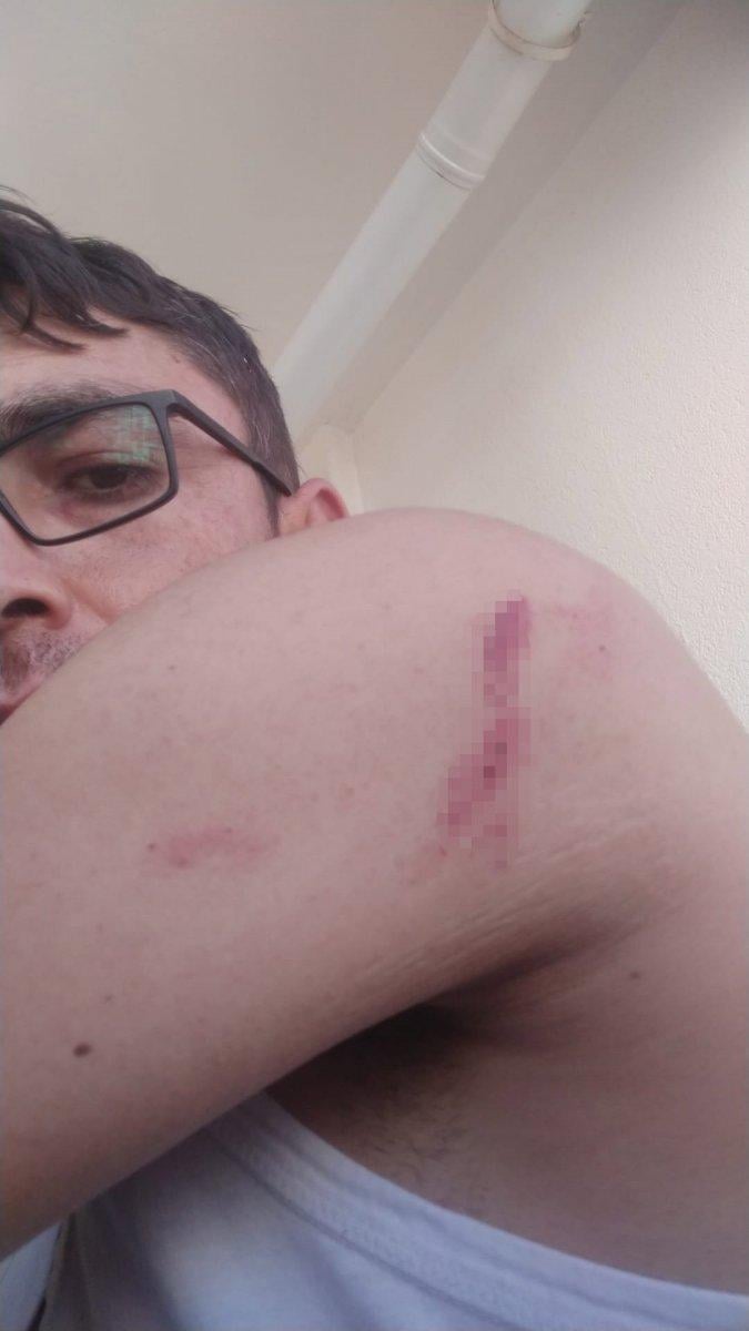 Nevşehir'de komşular arasındaki kavgada kulak memesi kopartıldı